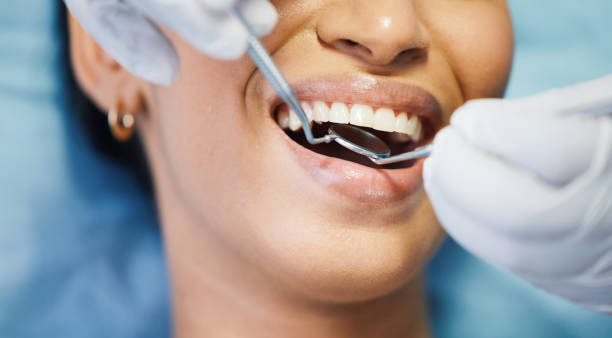Best Emergency Dentist for Knocked-Out Tooth in West Hurley, NY