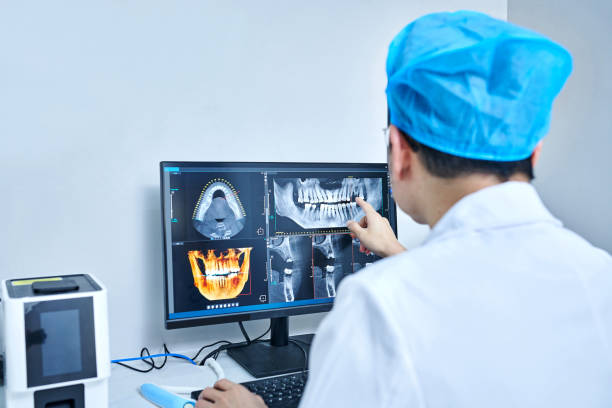 Best Emergency Dentist for Lost Fillings or Crowns in West Hurley, NY